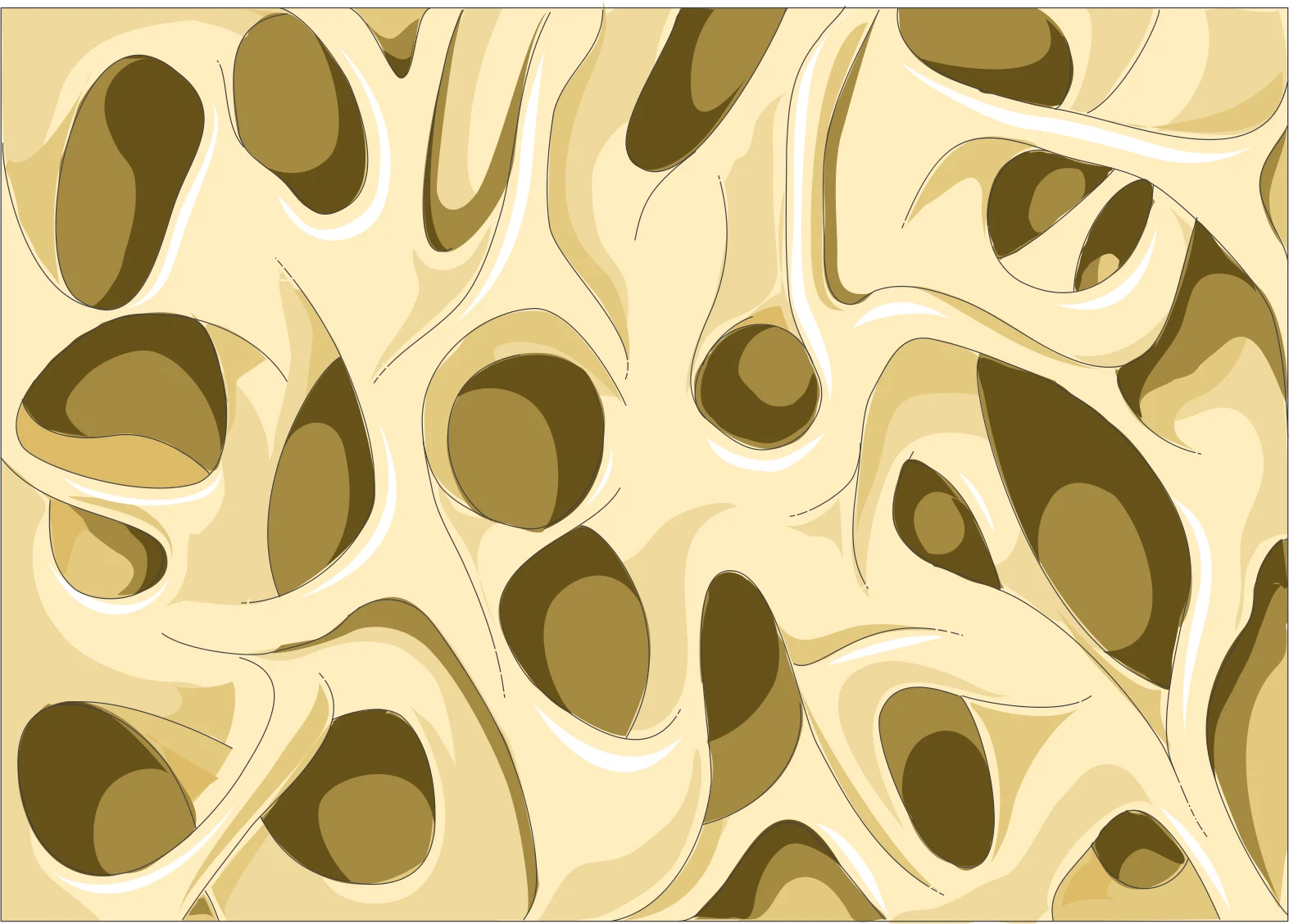 Ilustração do interior do osso com osteoporose: a trama óssea aparece rarefeita, com espaços vazios maiores entre as traves de osso